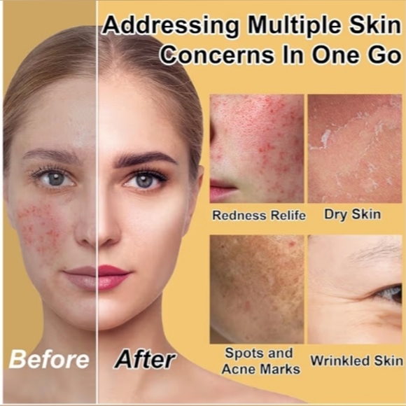 Deep Hydration & Repairing Skincare Set - NIB - Picture 2 of 6